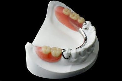 保険診療による部分入れ歯